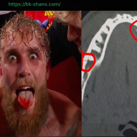 Джейк Пол о Двойном Переломе Челюсти и Планах Возвращения: Нганну Бросает Вызов