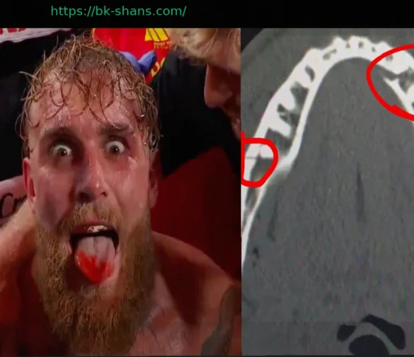 Джейк Пол о Двойном Переломе Челюсти и Планах Возвращения: Нганну Бросает Вызов